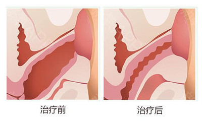 好手艺缩阴术