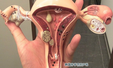 女性生殖器官结构模型