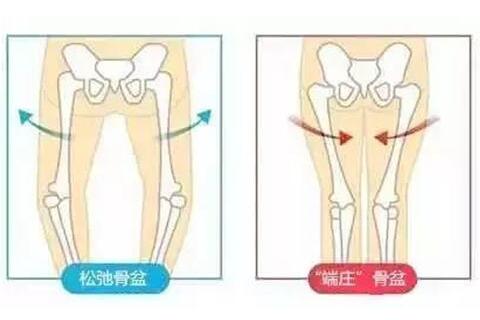 徒手纠正盆骨示意图