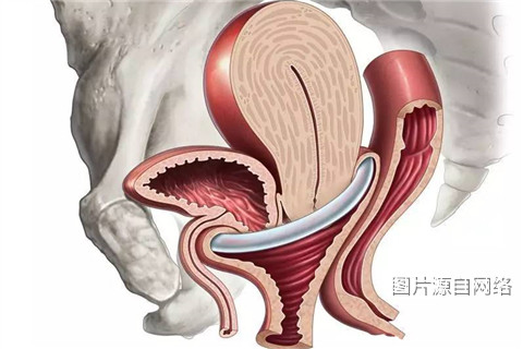 小心便秘可能是阴道壁膨出引起的