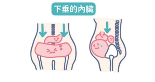 好手艺妇科下垂的盆腔脏器