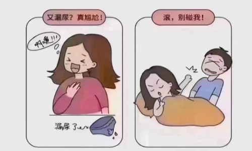 漏尿的苦恼