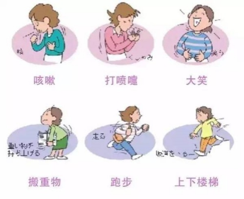 女性产后会出现的漏尿的情况分析