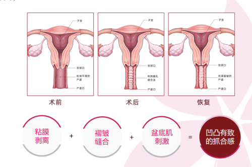 手术过程