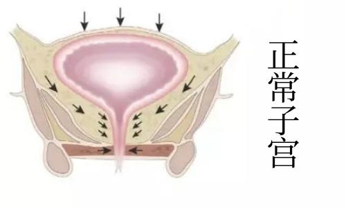 正常子宫.jpg