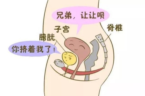 子宫挤压其他器官